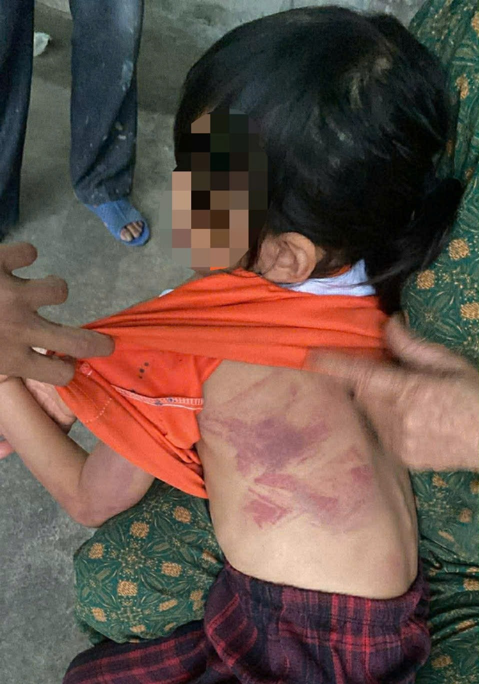 B&eacute; g&aacute;i lớp 2 bị bạn nam c&ugrave;ng lớp d&ugrave;ng thước dẻo đ&aacute;nh th&acirc;m t&iacute;m người v&igrave; kh&ocirc;ng cho kẹo - Ảnh 1.