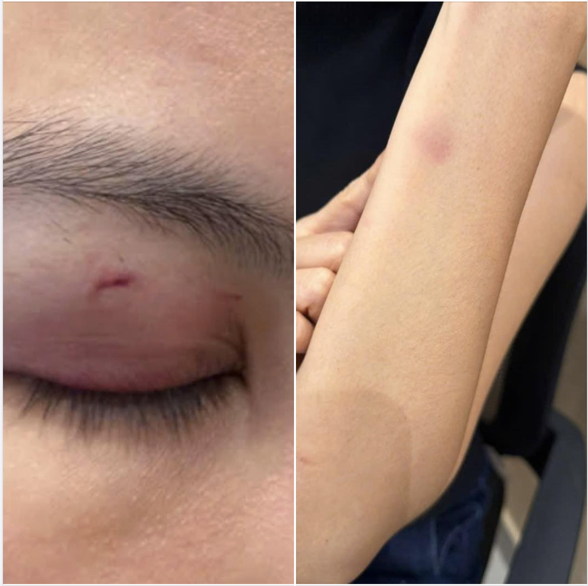 B&aacute;c sĩ thẩm mỹ tố ca sĩ Trung Qu&acirc;n "t&aacute;c động vật l&yacute;" vợ m&igrave;nh l&agrave; ai?- Ảnh 1.