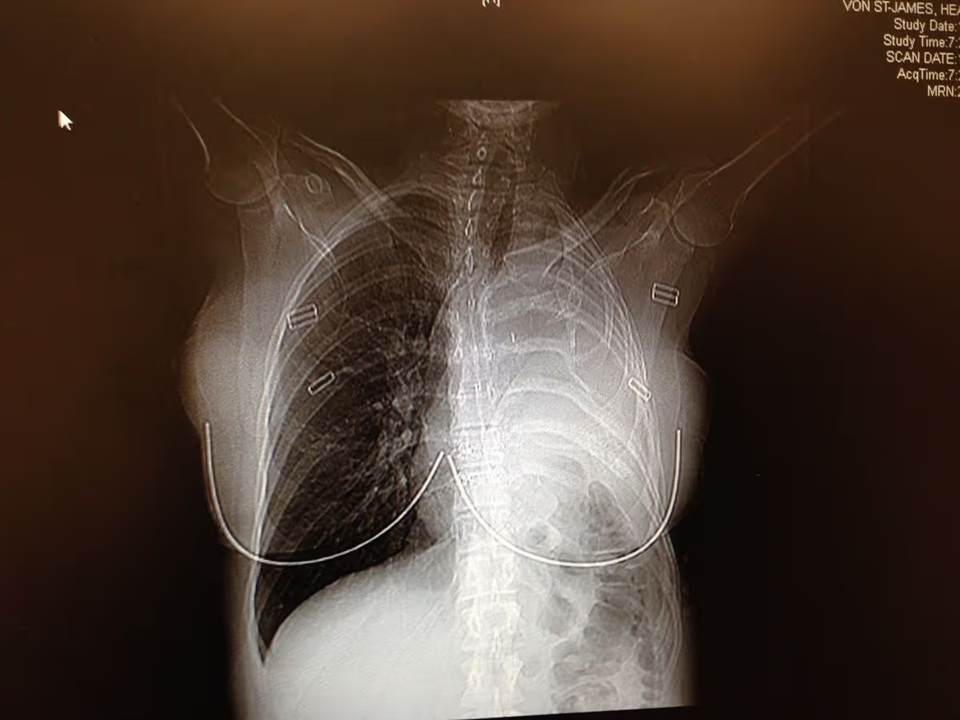 Người phụ nữ 36 tuổi chỉ c&ograve;n sống được 15 th&aacute;ng v&igrave; hồi nhỏ th&iacute;ch mặc &aacute;o của bố  - Ảnh 2.