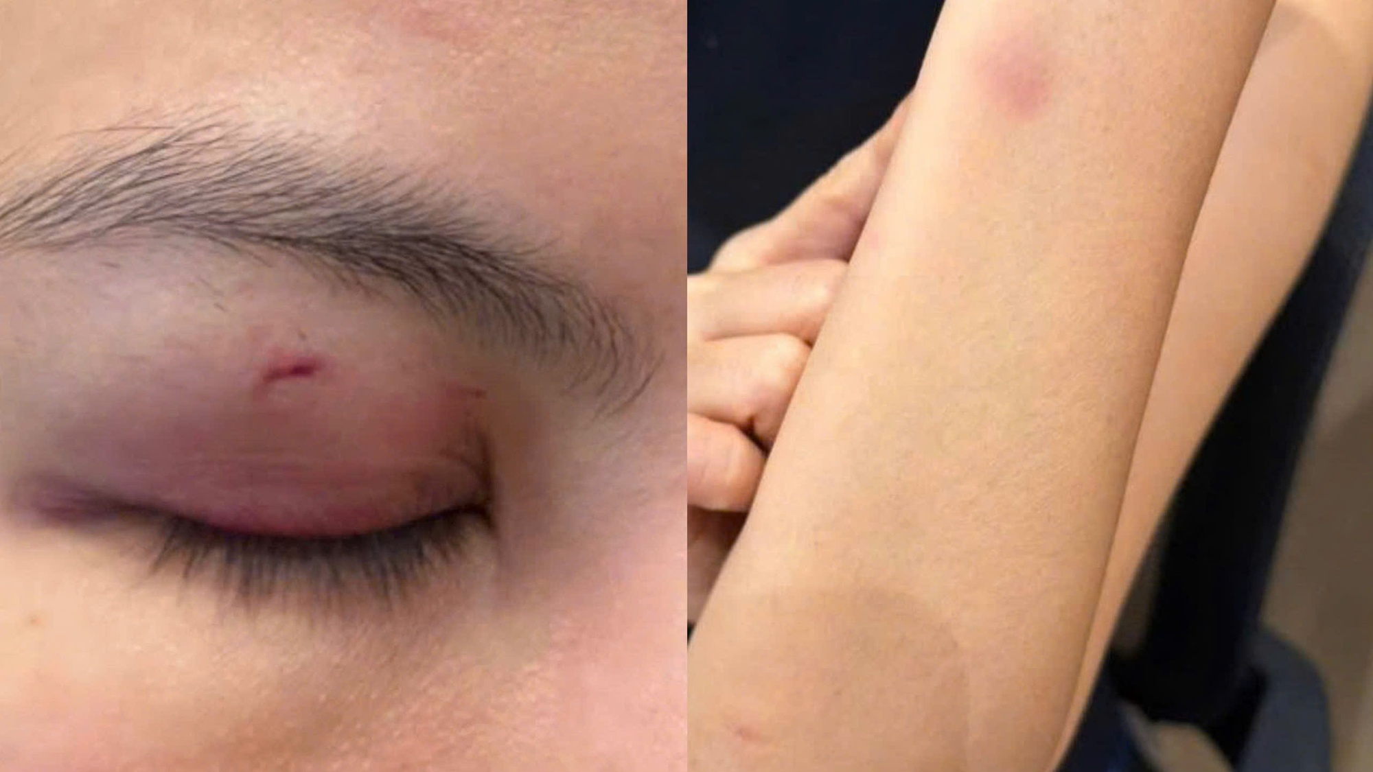 Luật sư nhận định vụ ca sĩ Trung Qu&acirc;n Idol bị tố đ&aacute;nh phụ nữ - Ảnh 1.