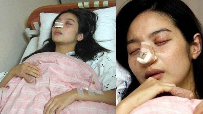 Bi kịch nữ diễn vi&ecirc;n ly h&ocirc;n sau 12 ng&agrave;y cưới v&igrave; bị chồng đ&aacute;nh sảy thai, nh&igrave;n thương t&iacute;ch m&agrave; nh&oacute;i l&ograve;ng- Ảnh 2.