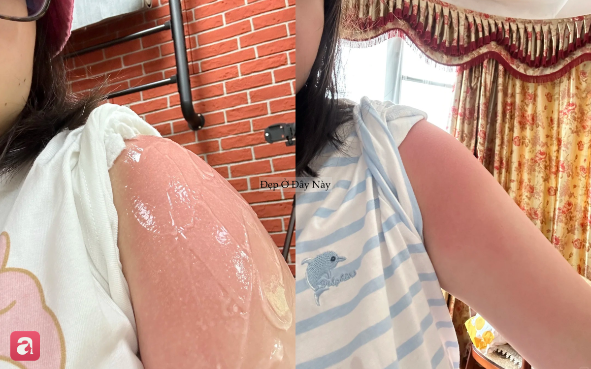 Lọ gel "thần kỳ" của m&ugrave;a h&egrave;: Chỉ hơn 100k nhưng đảm nhiệm đủ vai tr&ograve; từ cấp ẩm đến chống l&atilde;o h&oacute;a - Ảnh 3.