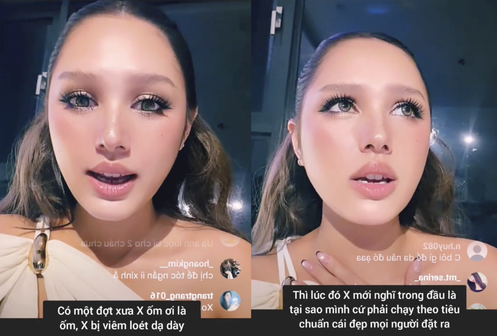 Xo&agrave;i Non: "Ăn g&igrave; cũng n&ocirc;n, b&aacute;c sĩ bảo trễ 1 ch&uacute;t nữa l&agrave; nguy hiểm, khi ấy t&ocirc;i mới nhận ra..."- Ảnh 1.