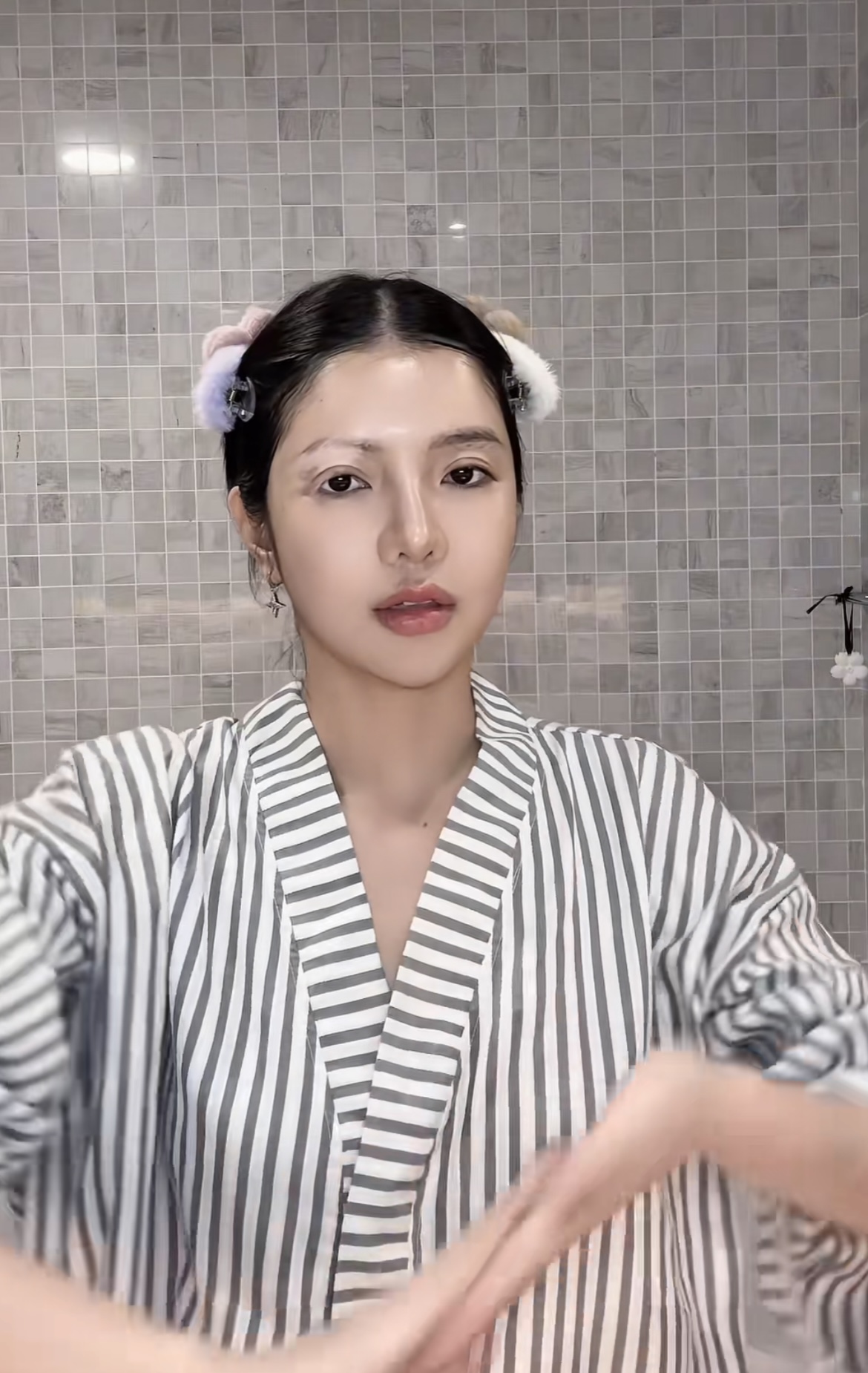 Mỹ nh&acirc;n Việt mắc bệnh hiếm chỉ 2% d&acirc;n số thế giới gặp phải- Ảnh 1.