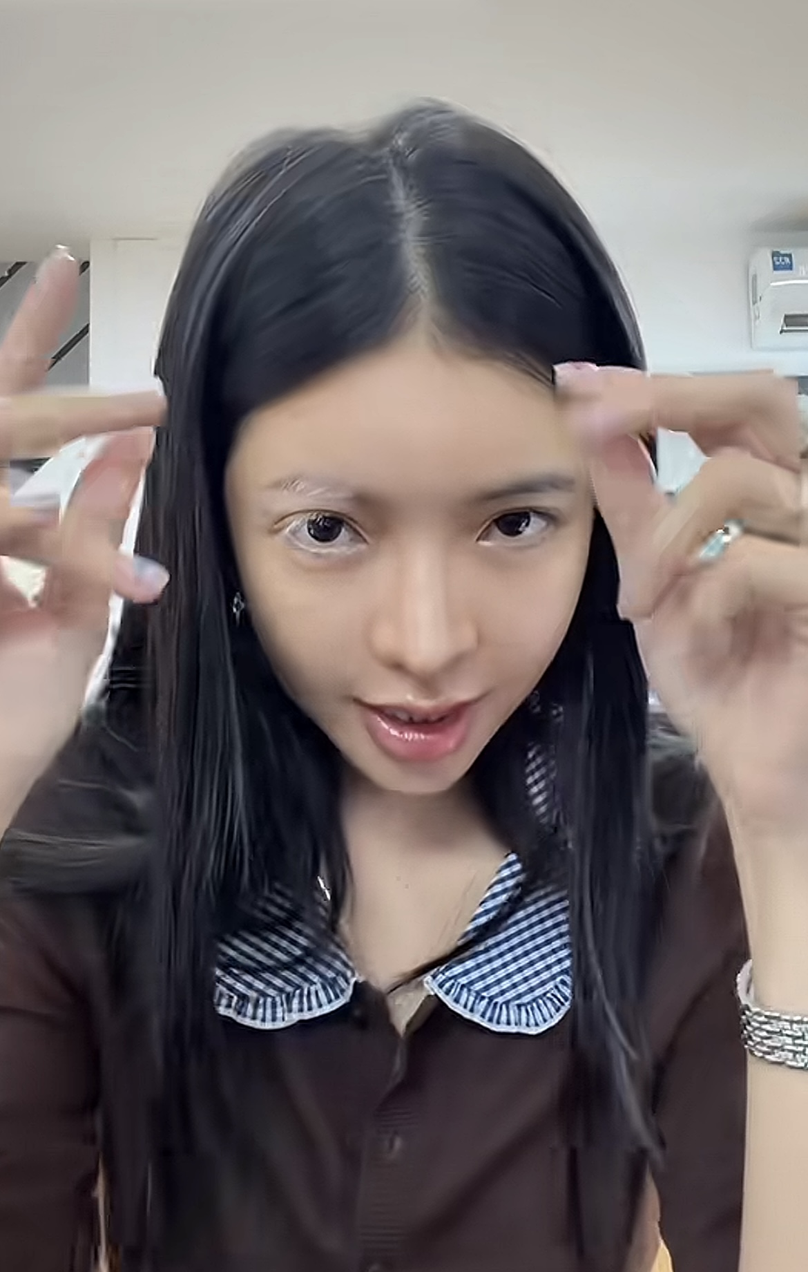 Mỹ nh&acirc;n Việt mắc bệnh hiếm chỉ 2% d&acirc;n số thế giới gặp phải- Ảnh 2.