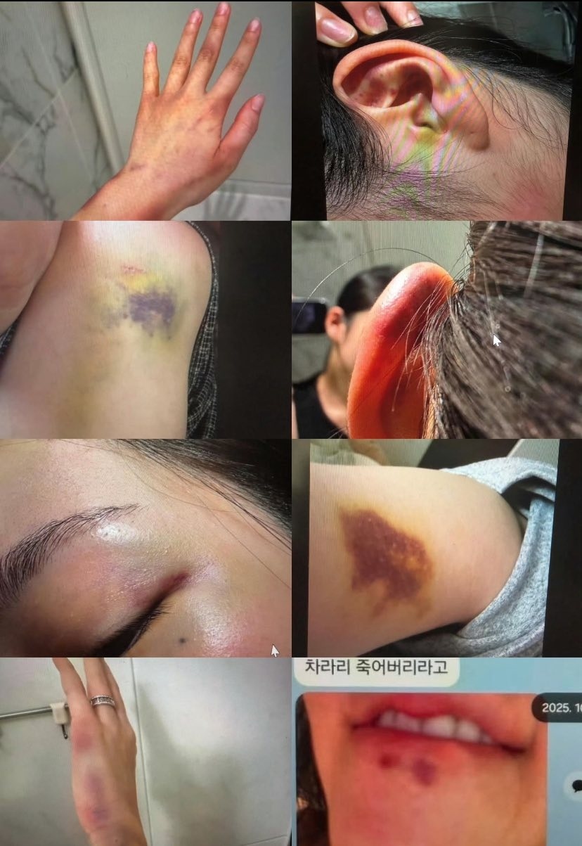 Ph&oacute;ng vi&ecirc;n H&agrave;n phỏng vấn độc quyền vợ của anh trai Jisoo, chỉ 1 c&acirc;u liền r&otilde; Idol nh&oacute;m BLACKPINK c&oacute; bao che tội &aacute;c hay kh&ocirc;ng- Ảnh 5.