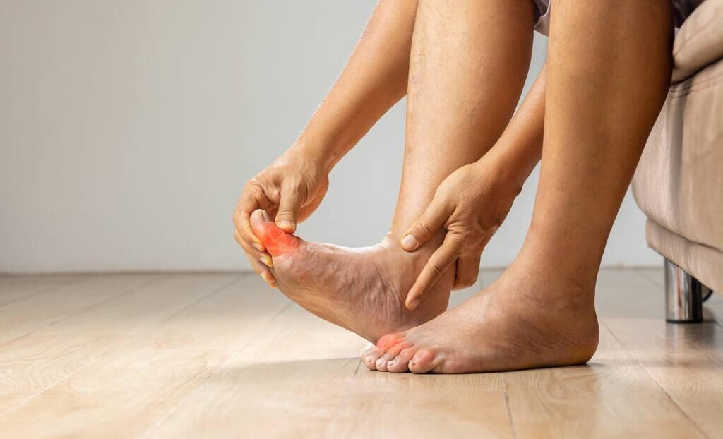 Chế độ ăn cho người bị bệnh gout: Khuy&ecirc;n d&ugrave;ng 4 &ldquo;cao thủ&rdquo; hạ axit uric, đậu phụ l&agrave; một trong số đ&oacute;- Ảnh 4.