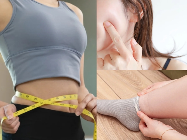 S&aacute;ng soi gương thấy mặt sưng d&ugrave; kh&ocirc;ng ăn nhiều: Đừng vội nhịn ăn, l&agrave;m ngay 3 việc để tr&ocirc;ng thon gọn hơn r&otilde; rệt v&agrave;o h&ocirc;m sau- Ảnh 1.