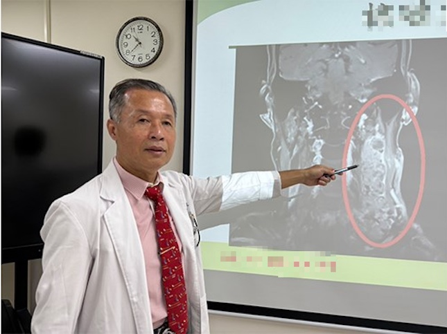 Nam gi&aacute;m đốc 60 tuổi sống rất l&agrave;nh mạnh vẫn mắc ung thư, b&aacute;c sĩ thở d&agrave;i: "3 thứ tr&ecirc;n cổ ĐỪNG xem nhẹ"- Ảnh 1.