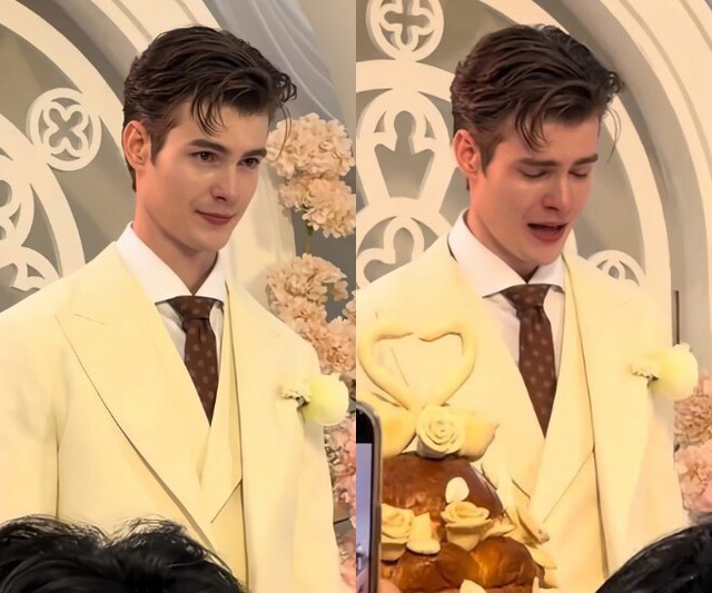 &Aacute;p lực v&igrave; lấy chồng qu&aacute; đẹp trai, c&ocirc; vợ 1m55 quyết phẫu thuật thẩm mỹ d&ugrave; chồng khẳng định "T&ocirc;i y&ecirc;u c&ocirc; ấy v&igrave; phẩm chất b&ecirc;n trong"- Ảnh 2.