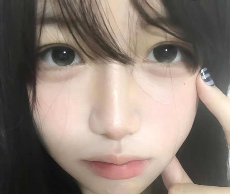 C&aacute;c b&aacute;c sĩ khuy&ecirc;n: Kh&ocirc;ng cần chờ tới l&uacute;c ngứa da, thấy 7 dấu hiệu n&agrave;y tr&ecirc;n mặt tức l&agrave; m&aacute;u đ&atilde; "ngập đường"- Ảnh 1.