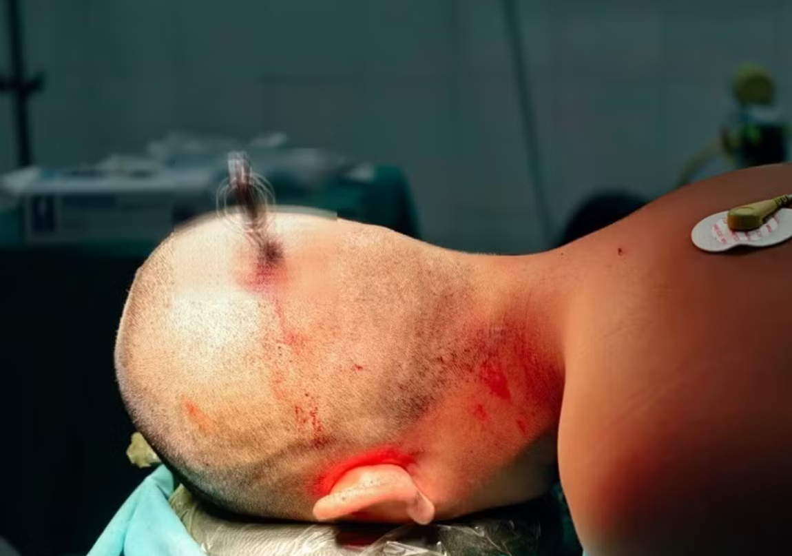 T&ocirc;i b&agrave;ng ho&agrave;ng khi đọc b&agrave;i CẢNH B&Aacute;O từ Bệnh viện Việt Đức: C&oacute; những tr&ograve; đ&ugrave;a của học sinh, c&ograve;n dung t&uacute;ng sẽ g&acirc;y hậu quả kh&ocirc;n lường!- Ảnh 1.