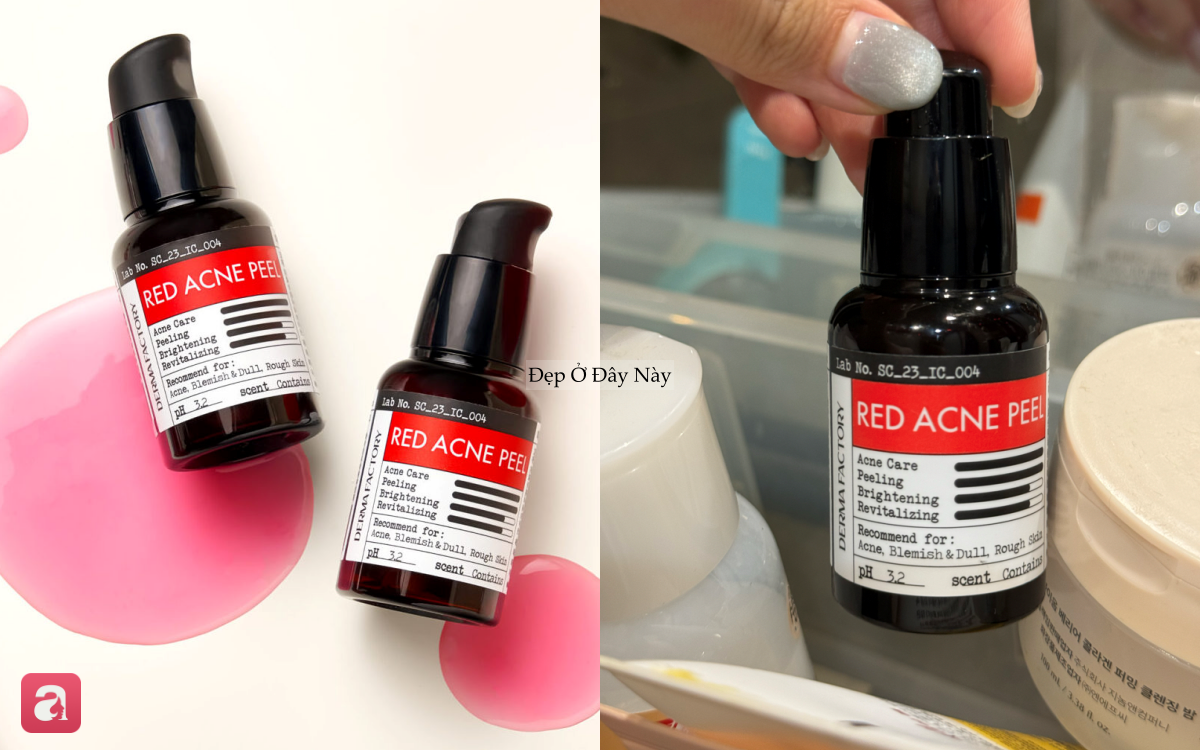 5  peel da tại nh&agrave; an to&agrave;n, l&agrave;nh t&iacute;nh khiến da như được "t&aacute;i sinh"- Ảnh 1.