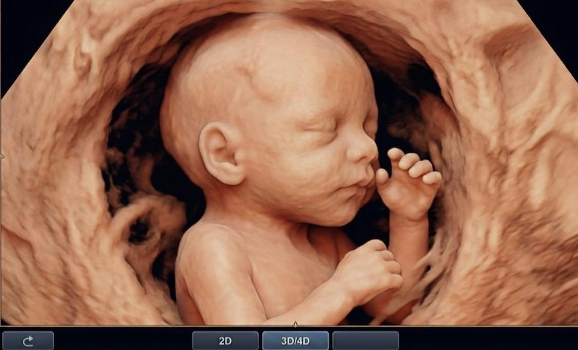 IVF c&oacute; l&agrave;m tăng tỷ lệ ung thư c&aacute;c loại? BS nam sản khoa tiết lộ sự thật - Ảnh 2.