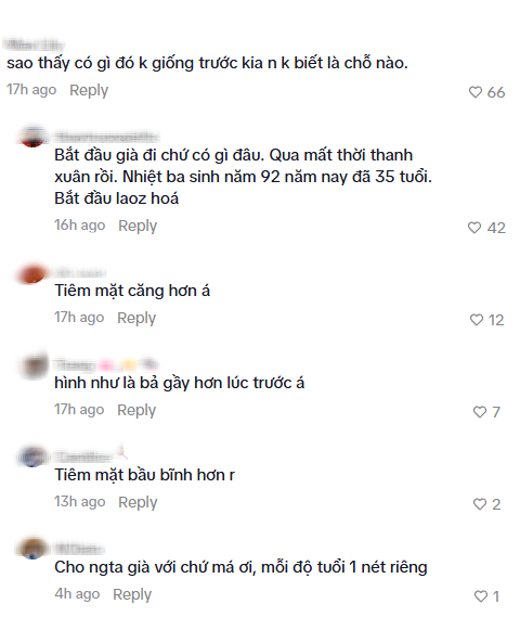 Địch Lệ Nhiệt Ba đ&atilde; l&agrave;m g&igrave; với gương mặt?- Ảnh 3.