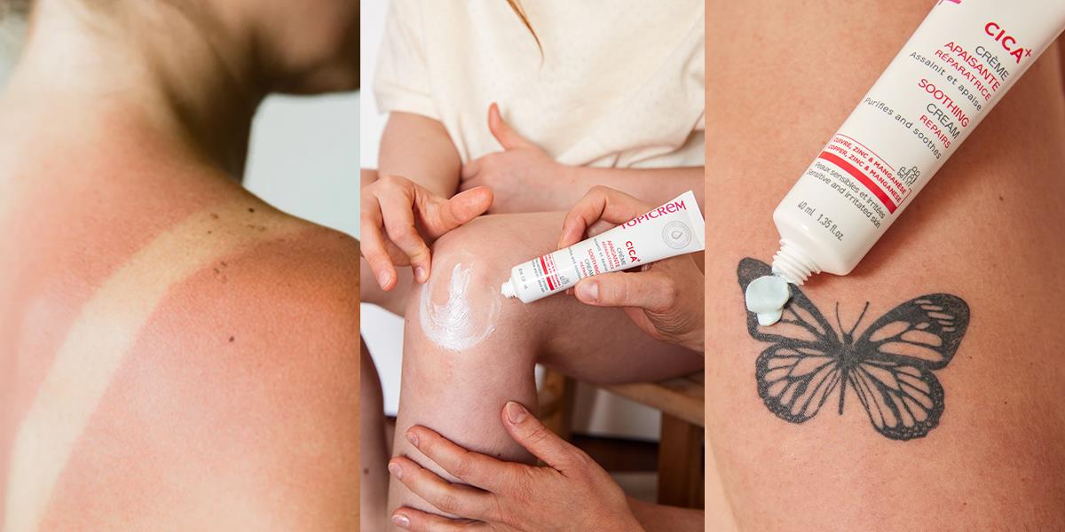 Sống nhanh, da cũng &ldquo;đuối&rdquo;: Đ&acirc;u l&agrave; giải ph&aacute;p phục hồi cho l&agrave;n da thương tổn?- Ảnh 2.