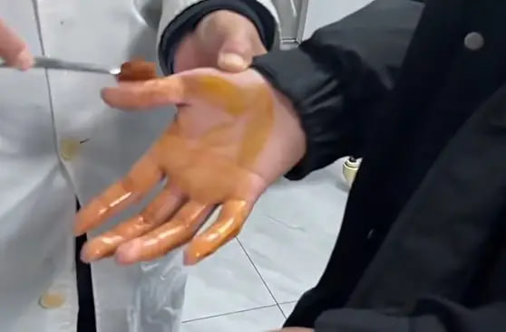 B&eacute; trai bị "kim v&ocirc; h&igrave;nh" từ 1 chiếc chăn đ&acirc;m khắp người, cha mẹ hoảng loạn, gỡ m&atilde;i kh&ocirc;ng hết- Ảnh 2.