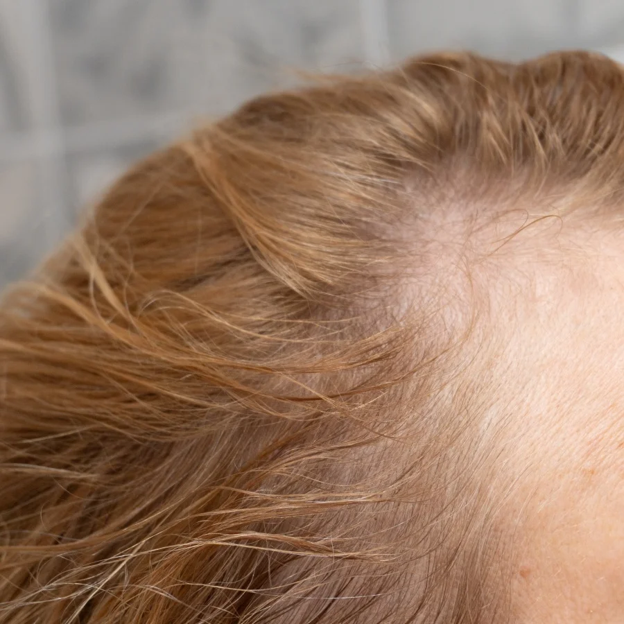 Lời khuy&ecirc;n cho người rụng t&oacute;c kinh ni&ecirc;n, đừng bỏ qua 15 m&oacute;n ăn n&agrave;y- Ảnh 17.