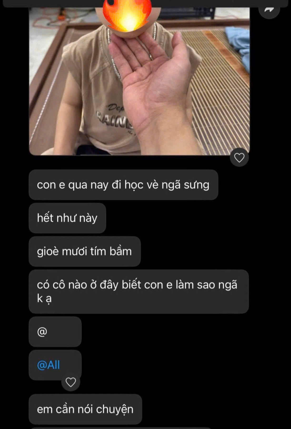 Con đi học về bị ng&atilde; sưng t&iacute;m, phụ huynh nhắn tin "tag all" nh&oacute;m lớp l&uacute;c 9h tối g&acirc;y tranh c&atilde;i khắp MXH- Ảnh 1.