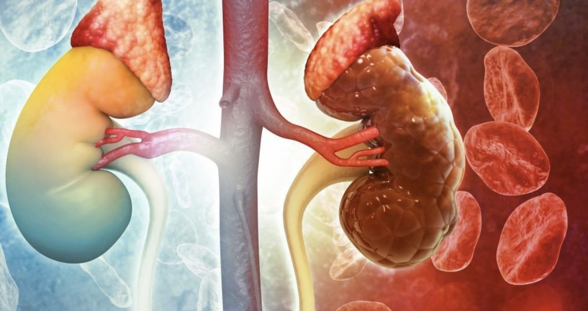 Ngủ sau khung giờ này, bạn đang tự “bào mòn” thận: Nguy cơ suy thận gần hơn bao giờ hết!- Ảnh 3. Ngủ sau khung giờ này, bạn đang tự “bào mòn” thận: Nguy cơ suy thận gần hơn bao giờ hết!- Ảnh 3.