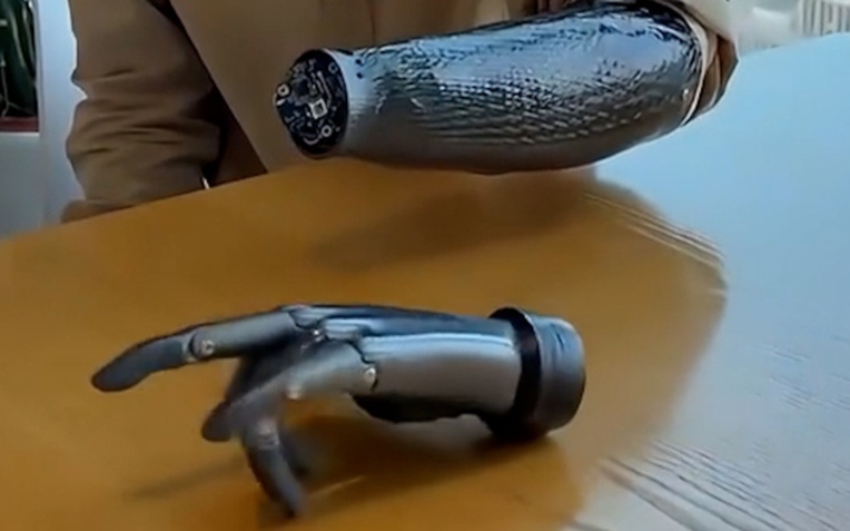 Trung Quốc lại một lần nữa khiến cả thế giới bất ngờ với c&aacute;nh tay giả c&oacute; thể "đọc" suy nghĩ v&agrave; di chuyển linh hoạt ngay cả khi kh&ocirc;ng kết nối với cơ thể người!- Ảnh 1.