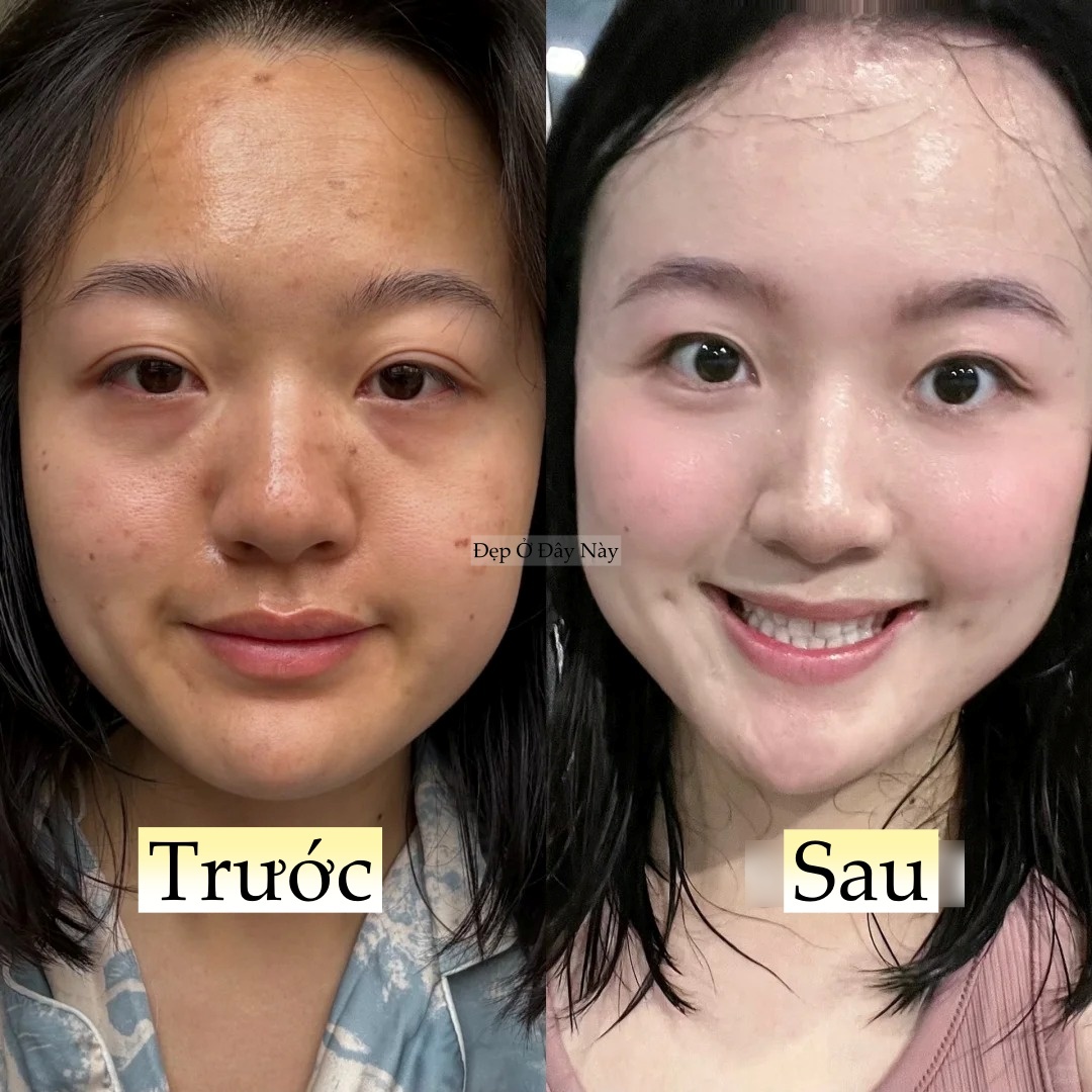 L&agrave;m 5 việc n&agrave;y khi đi ngủ, l&agrave;n da của t&ocirc;i như "thay da đổi thịt" ho&agrave;n to&agrave;n- Ảnh 2.