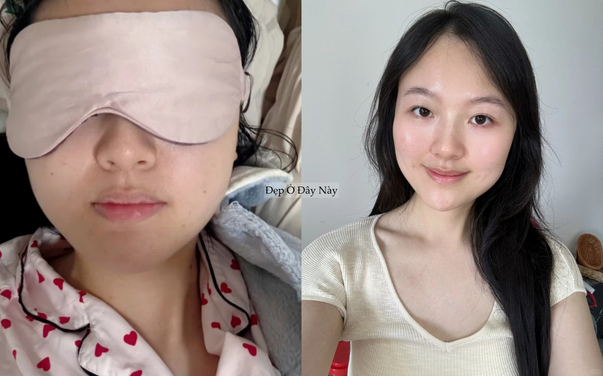 L&agrave;m 5 việc n&agrave;y khi đi ngủ, l&agrave;n da của t&ocirc;i như "thay da đổi thịt" ho&agrave;n to&agrave;n- Ảnh 6.