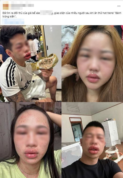 Tết Thanh Minh rủ nhau ăn b&aacute;nh trứng kiến: Người khen &ldquo;nổ b&ocirc;m bốp vui miệng&rdquo;, người th&igrave;&hellip; "đổi lu&ocirc;n giao diện" v&igrave; dị ứng- Ảnh 1.