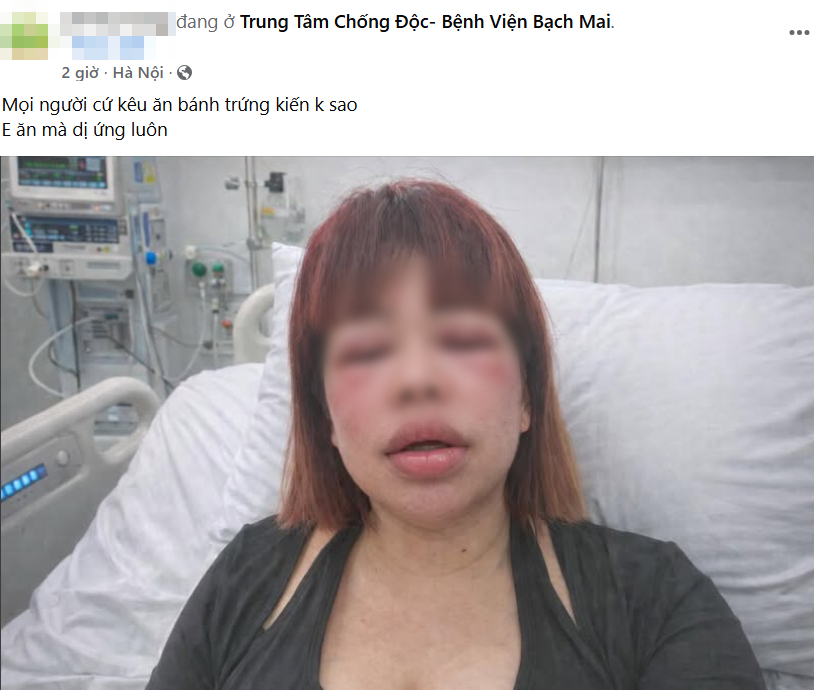 Tết Thanh Minh rủ nhau ăn b&aacute;nh trứng kiến: Người khen &ldquo;nổ b&ocirc;m bốp vui miệng&rdquo;, người th&igrave;&hellip; "đổi lu&ocirc;n giao diện" v&igrave; dị ứng- Ảnh 2.