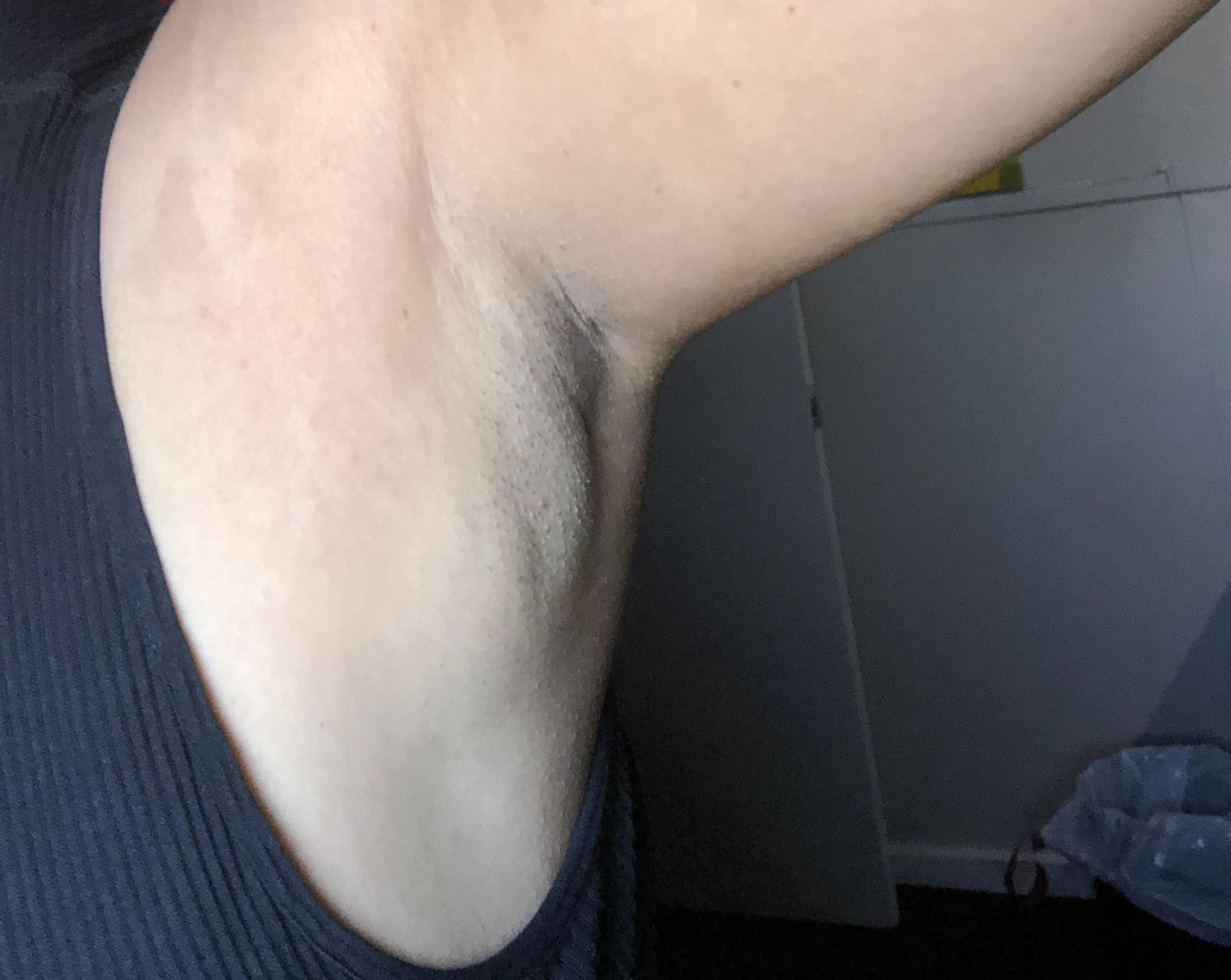 C&ocirc; g&aacute;i 22 tuổi nhận "&aacute;n tử" ung thư hạch d&ugrave; nhiều b&aacute;c sĩ n&oacute;i: "Tr&ocirc;ng c&ocirc; rất khỏe mạnh, kh&ocirc;ng sao đ&acirc;u"- Ảnh 3.