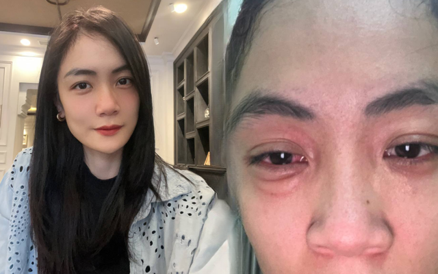 Đ&atilde; t&igrave;m ra "kỳ ph&ugrave;ng địch thủ" của gi&aacute; bể Hải Ph&ograve;ng: Phản ứng dở kh&oacute;c dở cười của hội thực kh&aacute;ch đu trend b&aacute;nh trứng kiến- Ảnh 6.