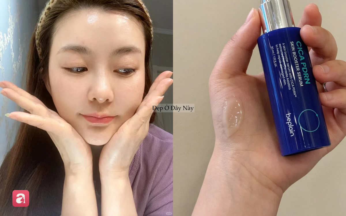 Đi ngủ sớm v&agrave; b&ocirc;i thứ n&agrave;y l&ecirc;n da mỗi tối, l&agrave;n da của t&ocirc;i sau 1 th&aacute;ng đ&atilde; thay đổi ho&agrave;n to&agrave;n- Ảnh 6.