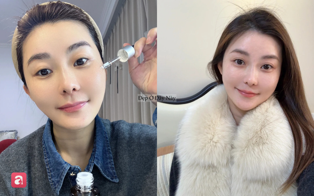 Đi ngủ sớm v&agrave; b&ocirc;i thứ n&agrave;y l&ecirc;n da mỗi tối, l&agrave;n da của t&ocirc;i sau 1 th&aacute;ng đ&atilde; thay đổi ho&agrave;n to&agrave;n- Ảnh 7.