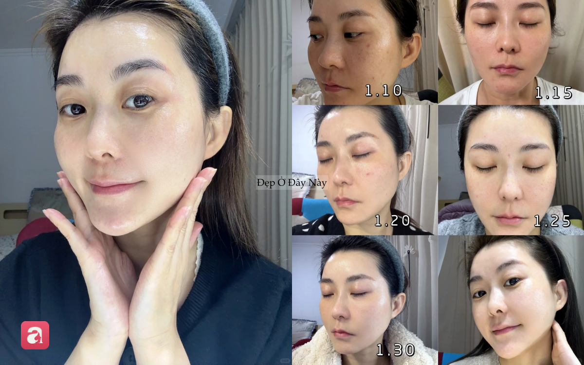 Đi ngủ sớm v&agrave; b&ocirc;i thứ n&agrave;y l&ecirc;n da mỗi tối, l&agrave;n da của t&ocirc;i sau 1 th&aacute;ng đ&atilde; thay đổi ho&agrave;n to&agrave;n- Ảnh 1.