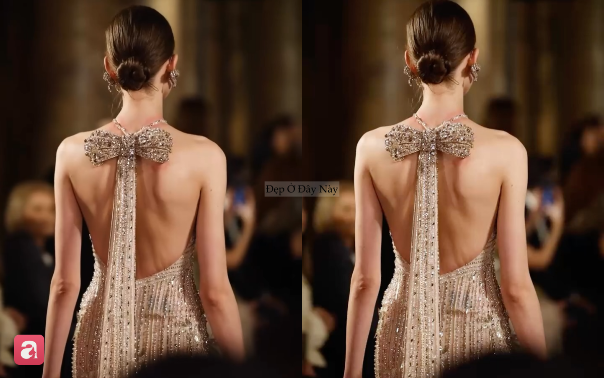 Nỗi đau ph&iacute;a sau chiếc đầm lộng lẫy khiến triệu người x&oacute;t xa- Ảnh 4.