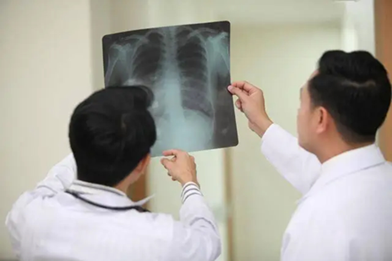 Khi ung thư mới bắt đầu h&igrave;nh th&agrave;nh, người ta thường cảm thấy 3 điều kh&ocirc;ng ổn, nhưng &iacute;t ai ch&uacute; &yacute; đến- Ảnh 3.