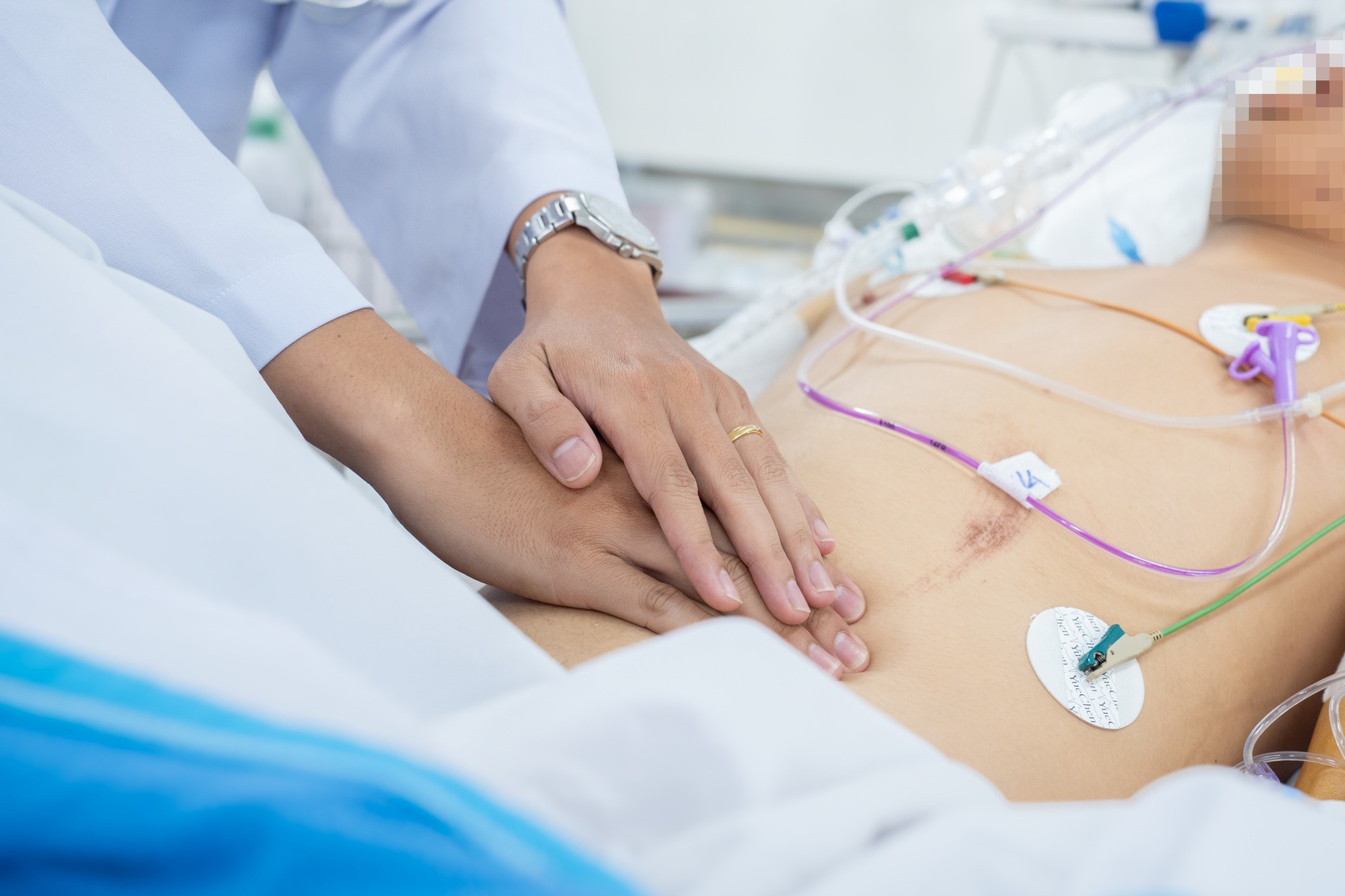 B&aacute;c sĩ Bệnh viện Chợ Rẫy mổ xuy&ecirc;n đ&ecirc;m cứu 2 nạn nh&acirc;n vụ xe kh&aacute;ch rơi xuống vực - Ảnh 3.