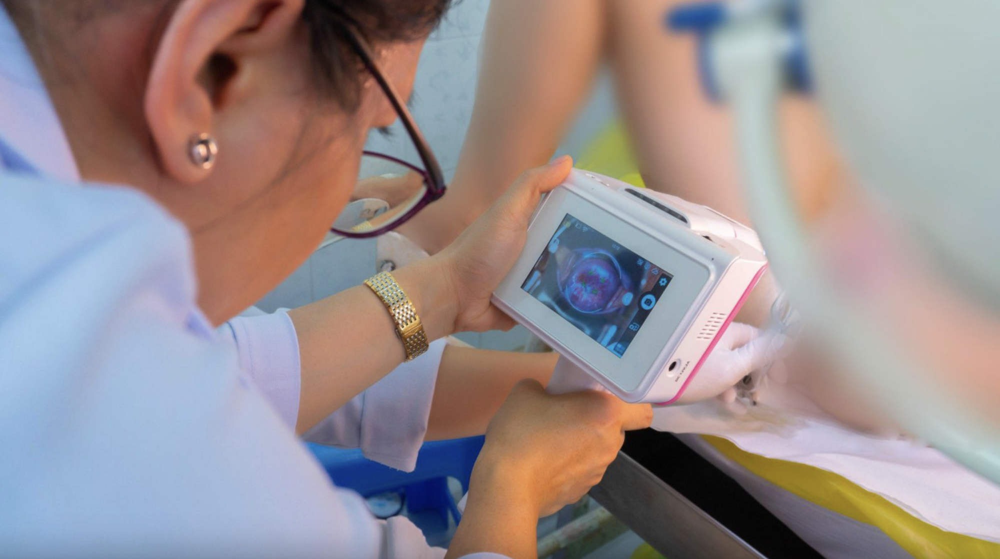 Tỉ lệ mắc ung thư cổ tử cung tại TPHCM cao hơn Hà Nội gấp 10 lần - Ảnh 3.