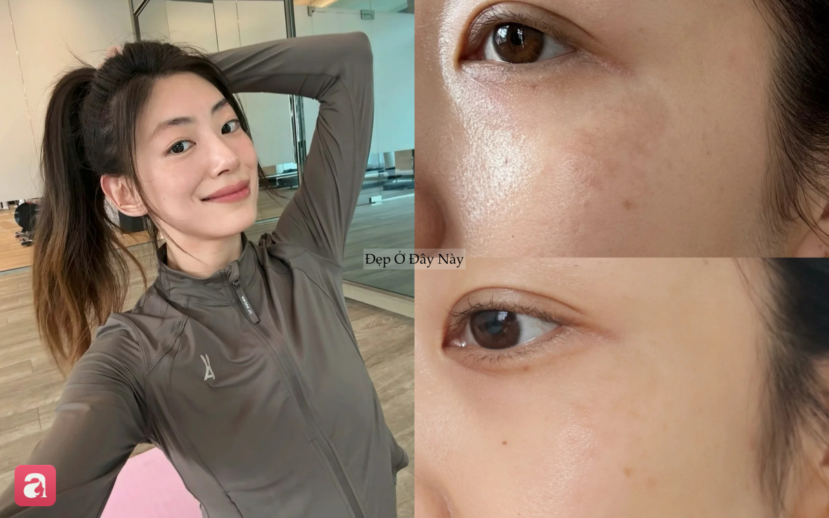 5 serum mờ n&aacute;m "made in Vietnam" được nhiều chị em khen nức nở- Ảnh 1.