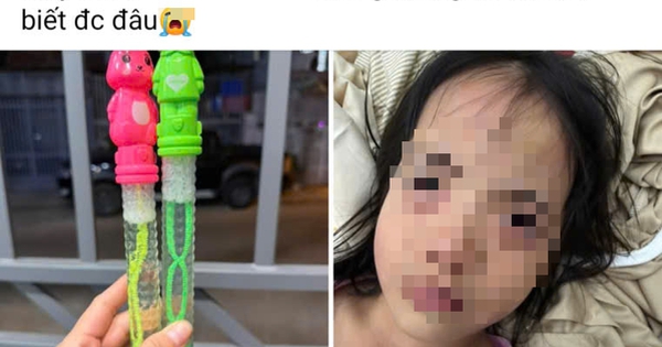 B&eacute; 7 tuổi ở TP.HCM bị rối loạn t&acirc;m thần cấp t&iacute;nh: B&aacute;c sĩ ph&aacute;t hiện thủ phạm đến từ miếng d&aacute;n chống say t&agrave;u xe - Ảnh 2.