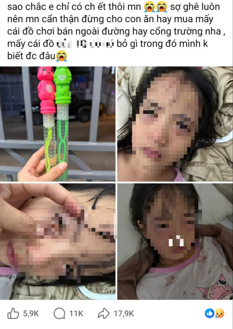 Bé gái 5 tuổi bị viêm kết mạc do đồ chơi thổi bong bóng xà phòng - Ảnh 1. Bé gái 5 tuổi bị viêm kết mạc do đồ chơi thổi bong bóng xà phòng - Ảnh 1.