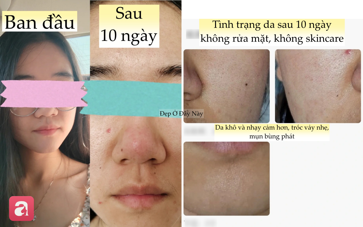 Thử th&aacute;ch kh&ocirc;ng rửa mặt trong 10 ng&agrave;y, c&ocirc; n&agrave;ng nhận kết quả "kh&ocirc;ng như mơ"- Ảnh 2.