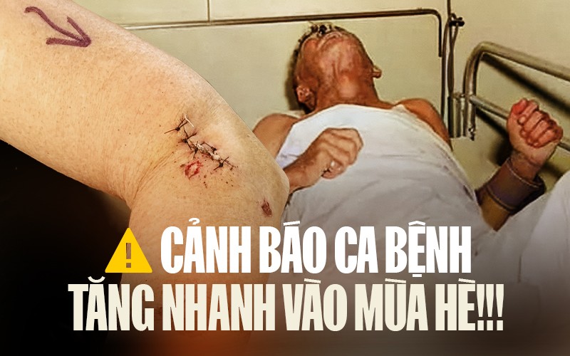 58 trẻ phải ti&ecirc;m ph&ograve;ng dại chỉ trong hơn 1 th&aacute;ng, nhiều ca ti&ecirc;n lượng tử vong cao: Bệnh viện Nhi Trung ương cảnh b&aacute;o khẩn! - Ảnh 1.
