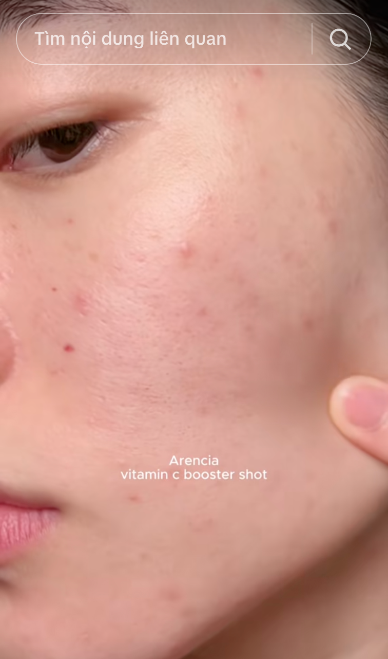 Da mặt th&acirc;m mụn, v&ugrave;ng n&aacute;ch sạm đen hay khuỷu tay th&ocirc; r&aacute;p: Phụ nữ H&agrave;n giải quyết tất cả bằng một tu&yacute;p Vitamin C - Ảnh 5.