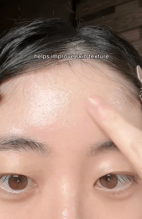 Da mặt th&acirc;m mụn, v&ugrave;ng n&aacute;ch sạm đen hay khuỷu tay th&ocirc; r&aacute;p: Phụ nữ H&agrave;n giải quyết tất cả bằng một tu&yacute;p Vitamin C - Ảnh 11.