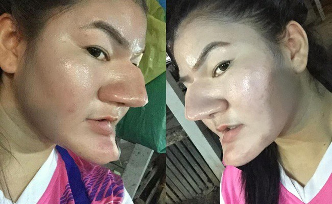 B&aacute;c sĩ thẩm mỹ: "V&igrave; sao c&agrave;ng sửa c&agrave;ng xấu?" - Ảnh 1.