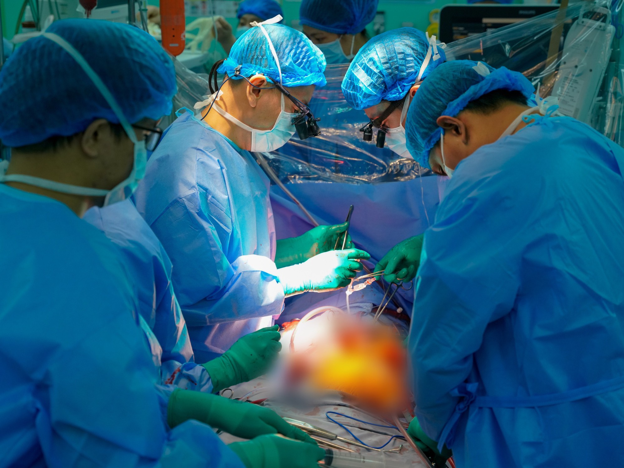 Tr&aacute;i tim bỗng đập trở lại trong lồng ngực người nhận gần ngừng tim, chạy ECMO suốt 8 ng&agrave;y, BS: "Một trong những ca hồi phục tốt nhất m&agrave; ch&uacute;ng t&ocirc;i từng thấy" - Ảnh 3.