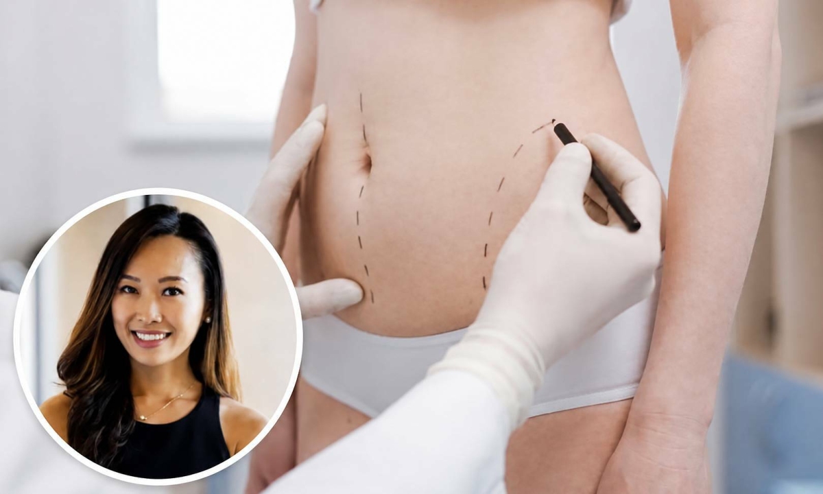 H&uacute;t mỡ ra ngo&agrave;i rồi đem cấp đ&ocirc;ng bảo quản, đợi chờ l&agrave;m đẹp trong tương lai: Cảnh b&aacute;o tr&agrave;o lưu tiềm ẩn rủi ro- Ảnh 2.