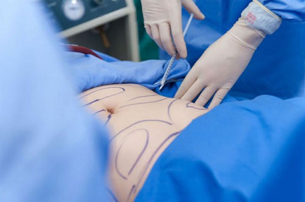 H&uacute;t mỡ ra ngo&agrave;i rồi đem cấp đ&ocirc;ng bảo quản, đợi chờ l&agrave;m đẹp trong tương lai: Cảnh b&aacute;o tr&agrave;o lưu tiềm ẩn rủi ro- Ảnh 1.