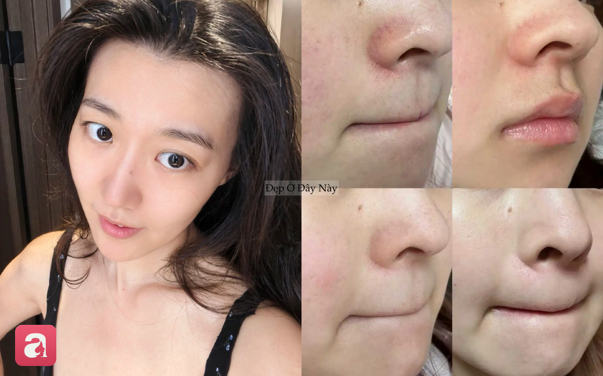 Tự "detox da" tại nh&agrave;: N&agrave;ng blogger U30 khiến l&agrave;n da thay đổi thấy r&otilde; - Ảnh 2.
